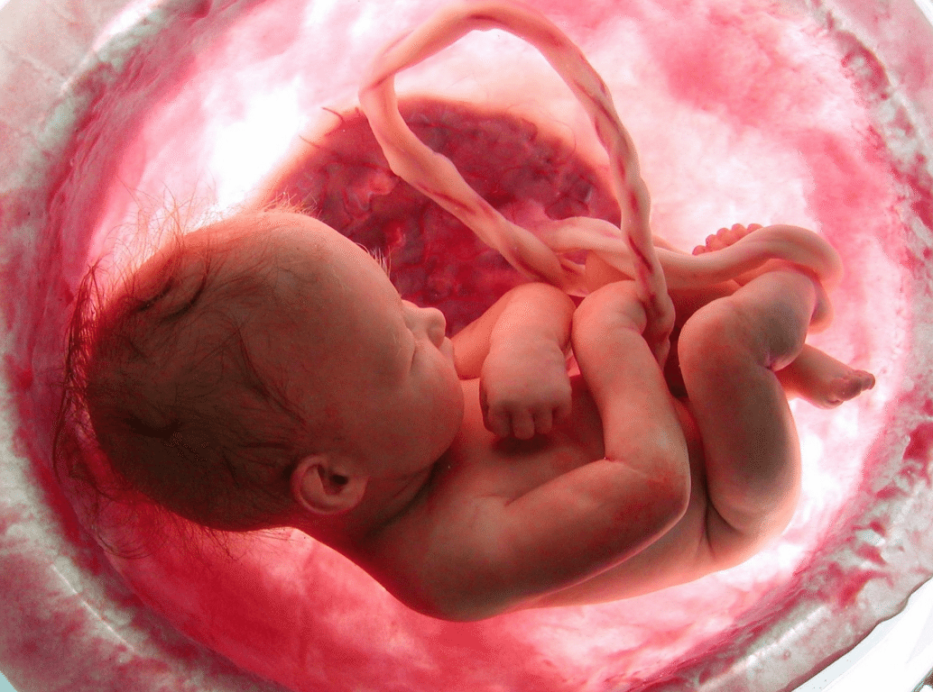 Resultado de imagem para um feto