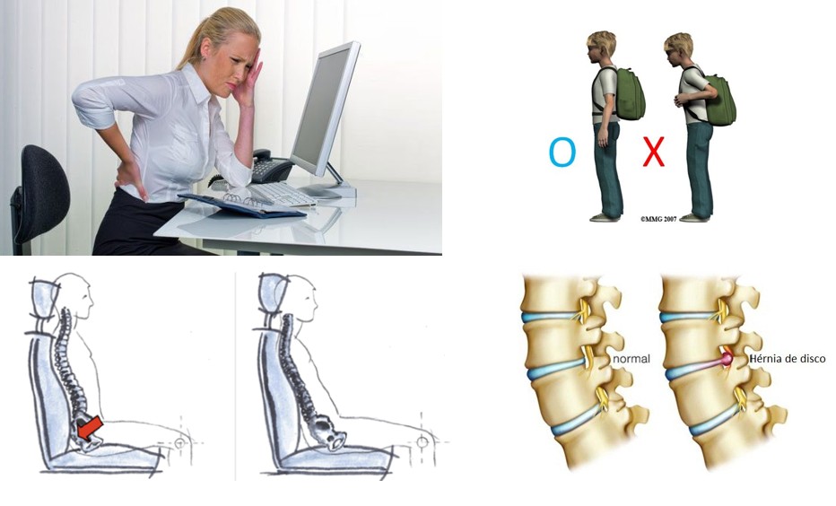 Como Aliviar A Dor Na Lombar Em Um Instante? Exercícios E Alongamento ...