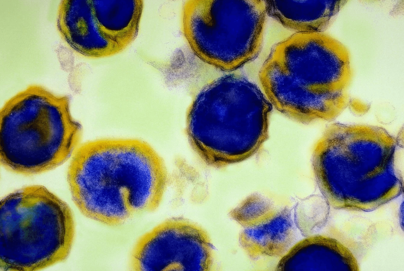 O que é Clamídia? Doença Sexualmente Transmissível Biosom Saúde e Bem Estar