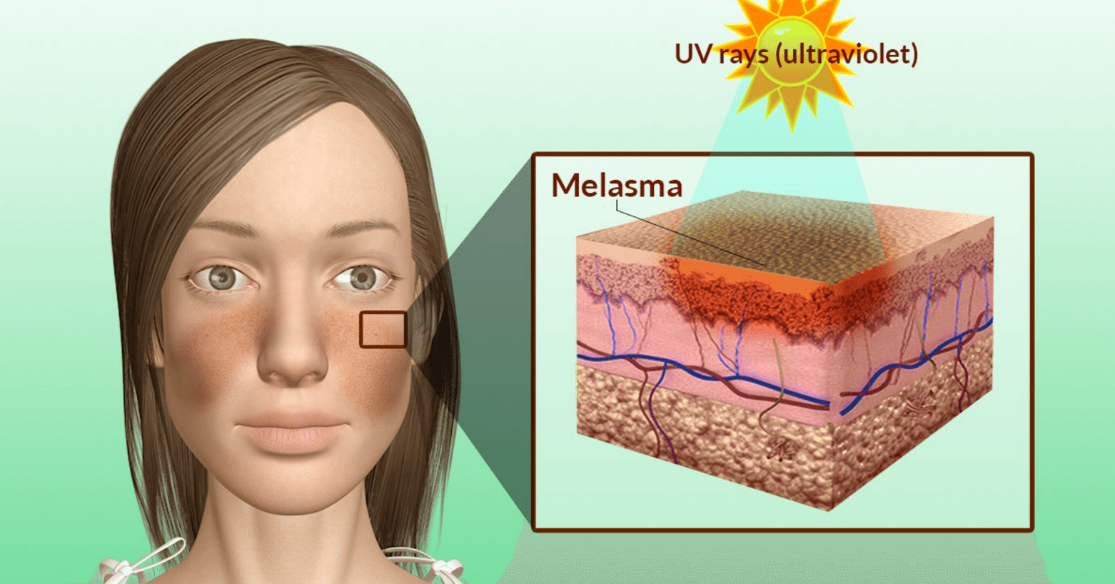 Как увеличить количество меланина в волосах
